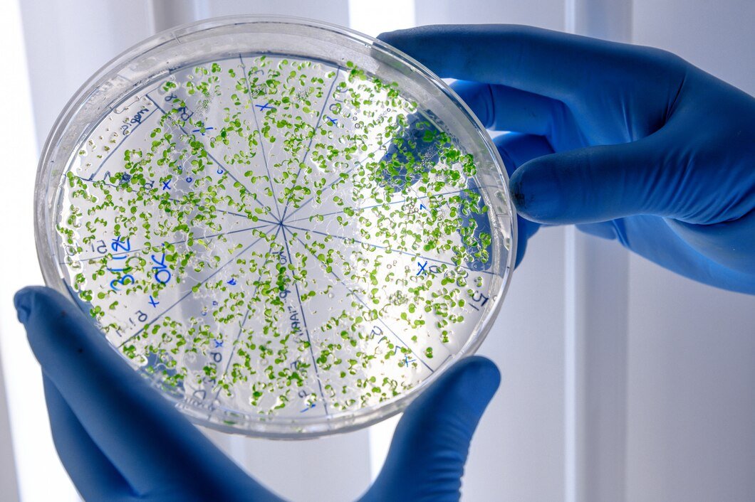 Recognise E. Coli in the Bloodstream