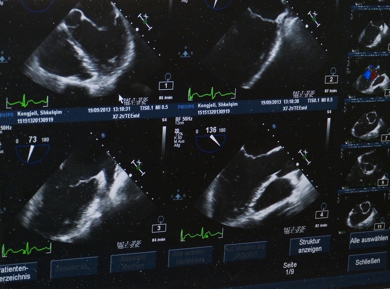 Ultrasound Tech vs Radiology Tech